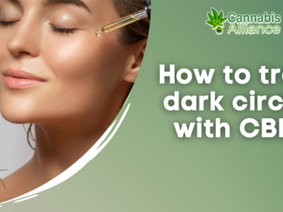 How to treat dark circles with CBD?